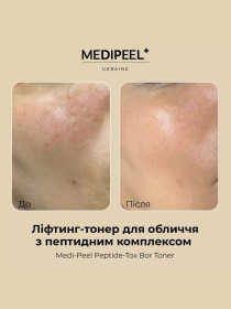 Тонер против морщин Medi-Peel модель 8809409348308 Фото