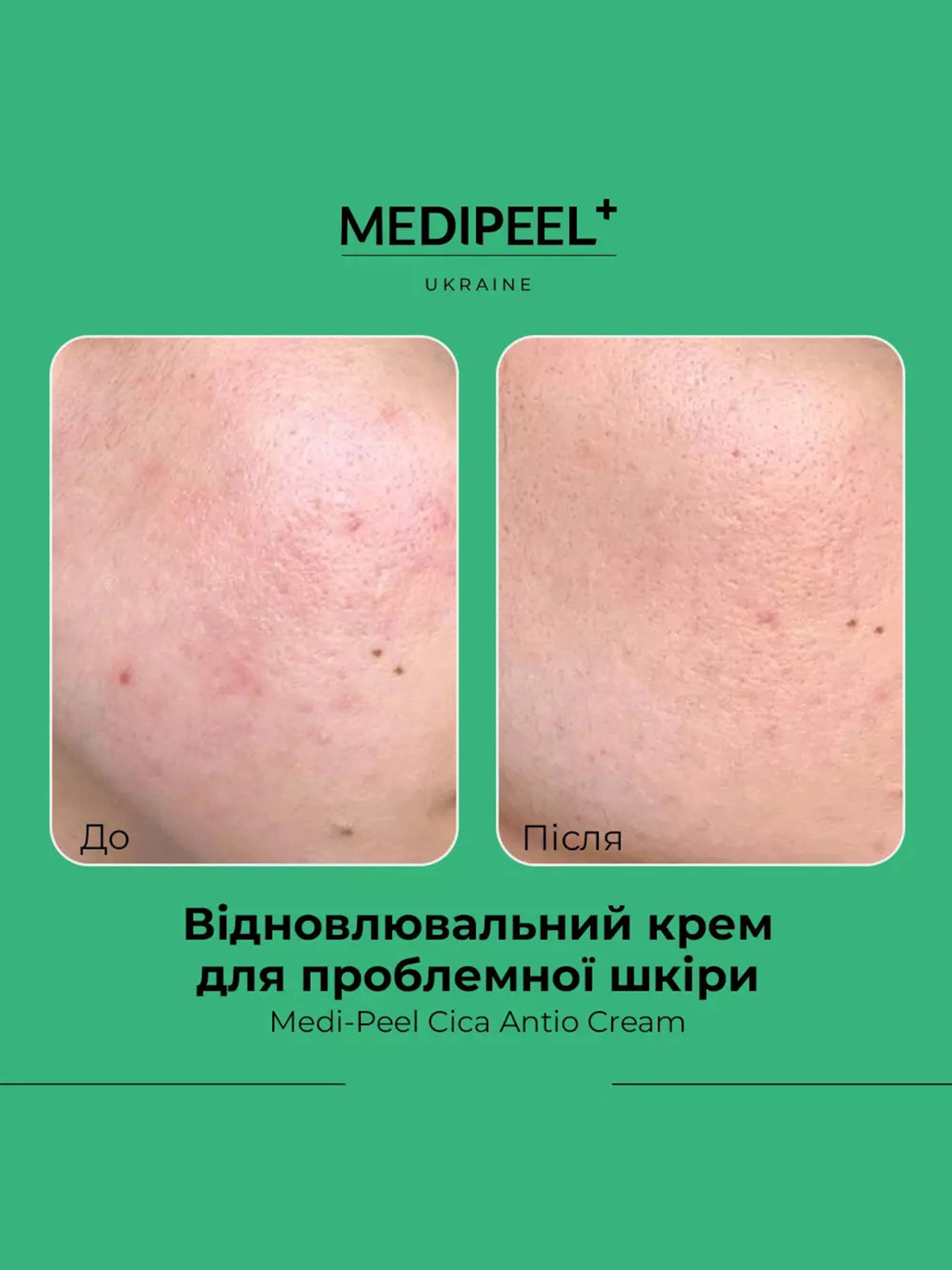 Крем відновлювальний Medi-Peel модель 8809409343549 Фото