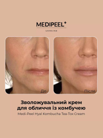 Крем увлажняющий с комбучей Medi-Peel модель 8809409346489 Фото