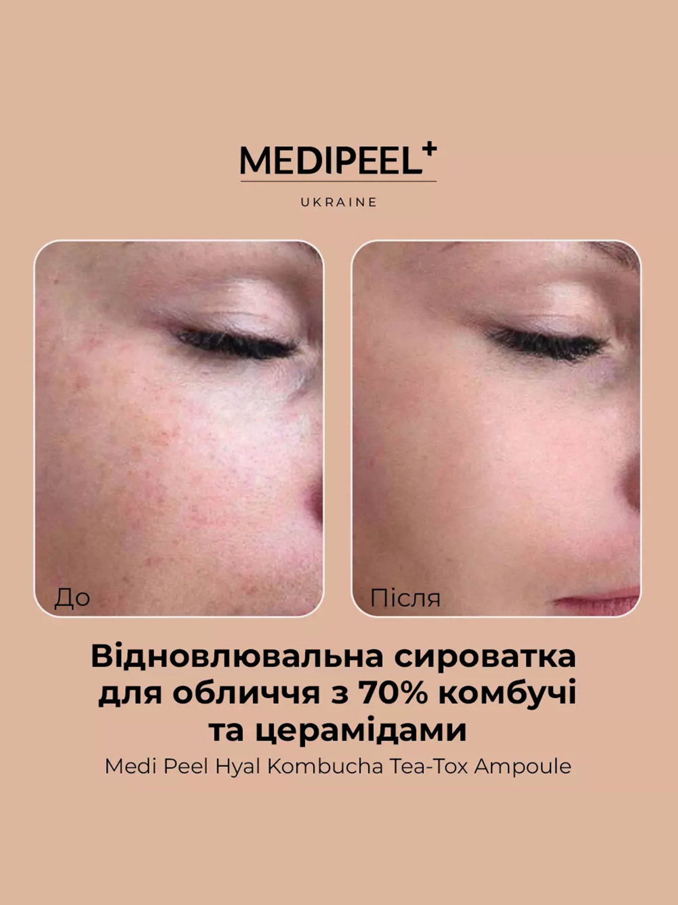 Сыворотка увлажняющая Medi-Peel модель 8809409346458 Фото