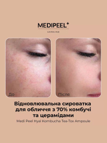 Сыворотка увлажняющая Medi-Peel модель 8809409346458 Фото