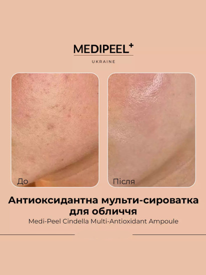 Medi-Peel ­Сироватка антиоксидантна модель 8809409345024 — фото 3 - INTERTOP