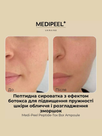 Сыворотка против морщин Medi-Peel модель 8809409341705 Фото