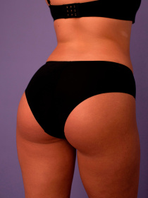 Труси Brabrabra модель SLZ19802003_black Фото