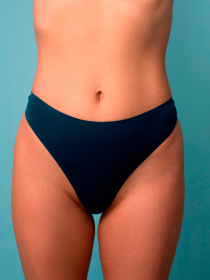 Трусы Brabrabra модель SLZ19802005_aquamarine Фото