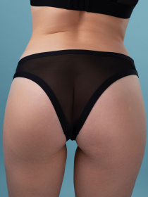 Труси Brabrabra модель SLZ22102004_Black Фото